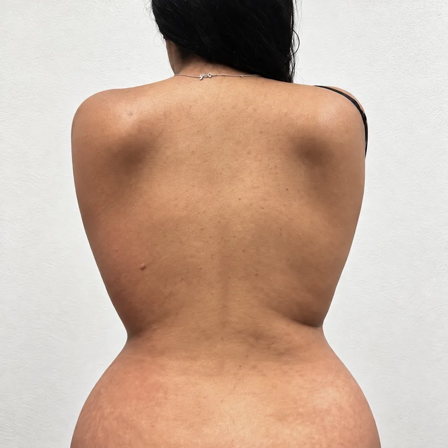 Después: Shape Your Body