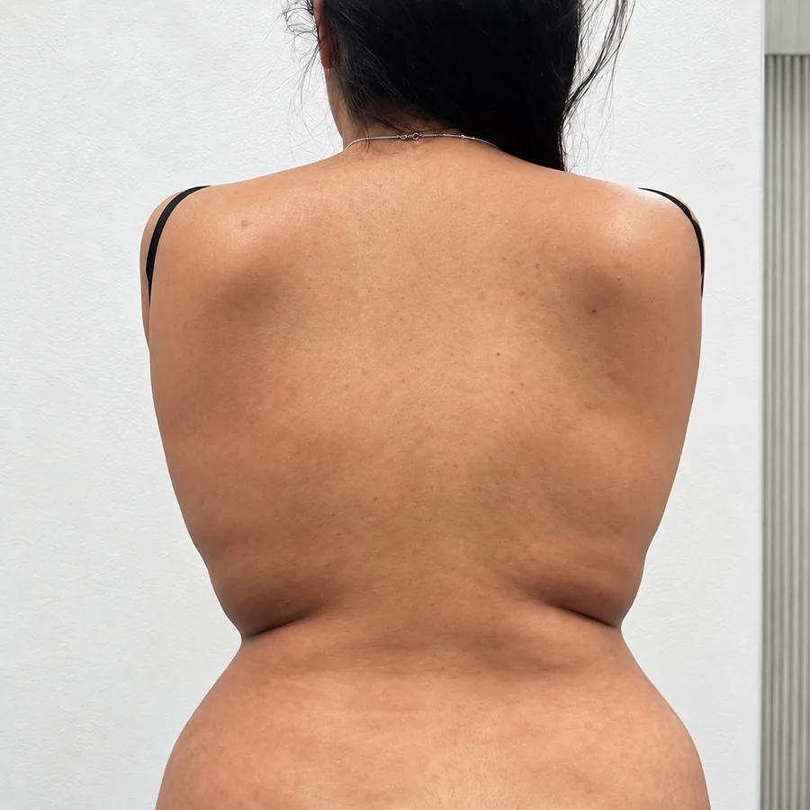 Antes: Shape Your Body